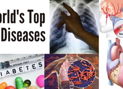 The top 10 causes of death in the world The top 10 causes of death in the world